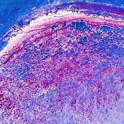 Epidermal I, 2022  ($250)