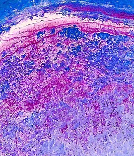 Epidermal I (detail), 2022